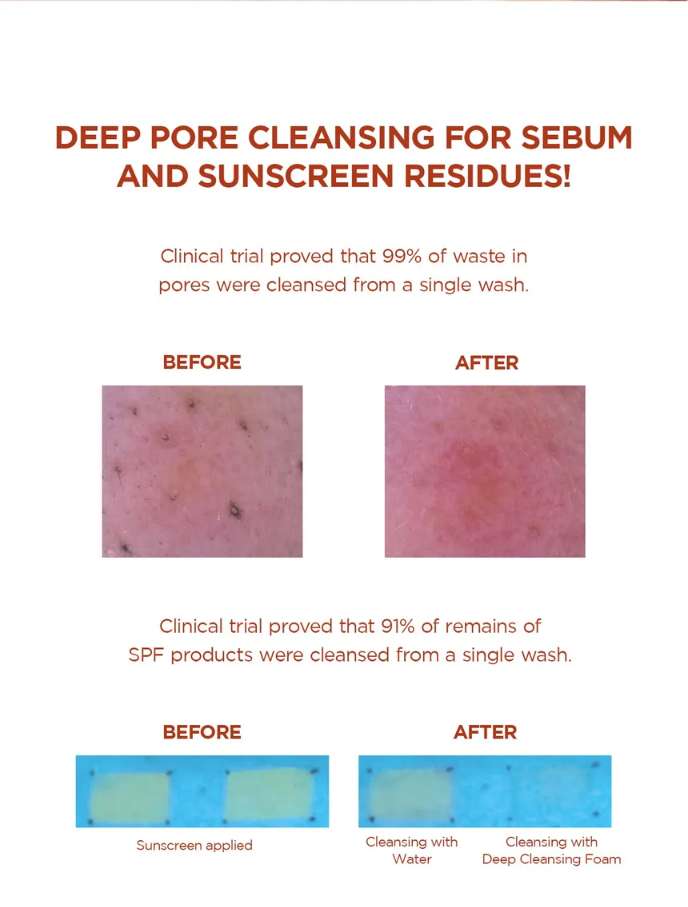SKIN 1004 - Madagascar Centella Poremizing Deep Cleansing Foam | 125ML